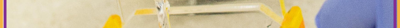 Best types of agarose gel banner image