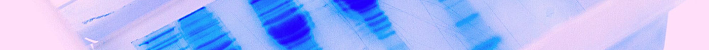 Western Blot Deep Dive: What It Is and How It Works