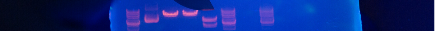 Interpreting gel electrophoresis results thumbnail