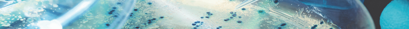 How Do Bacteria Develop Antibiotic Resistance?