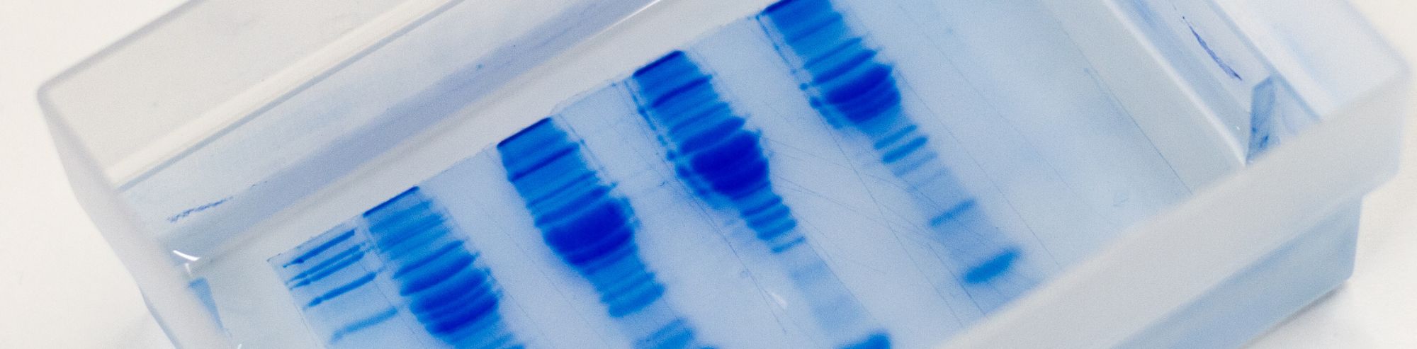 Introduction to Blotting Techniques in Molecular Biology