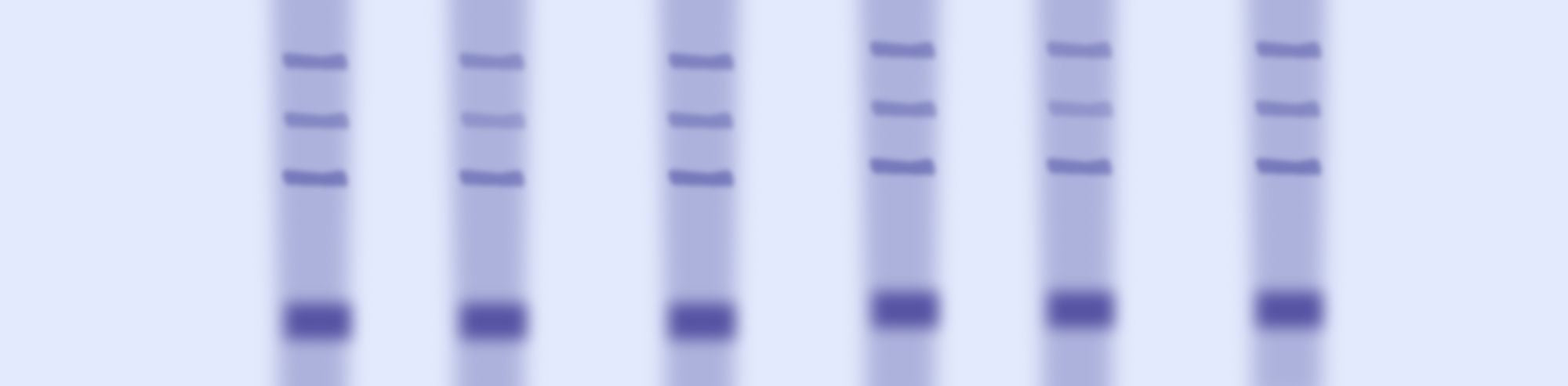 An Overview of Northern blot
