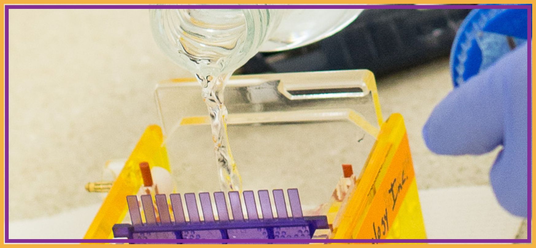 Best types of agarose gel banner image