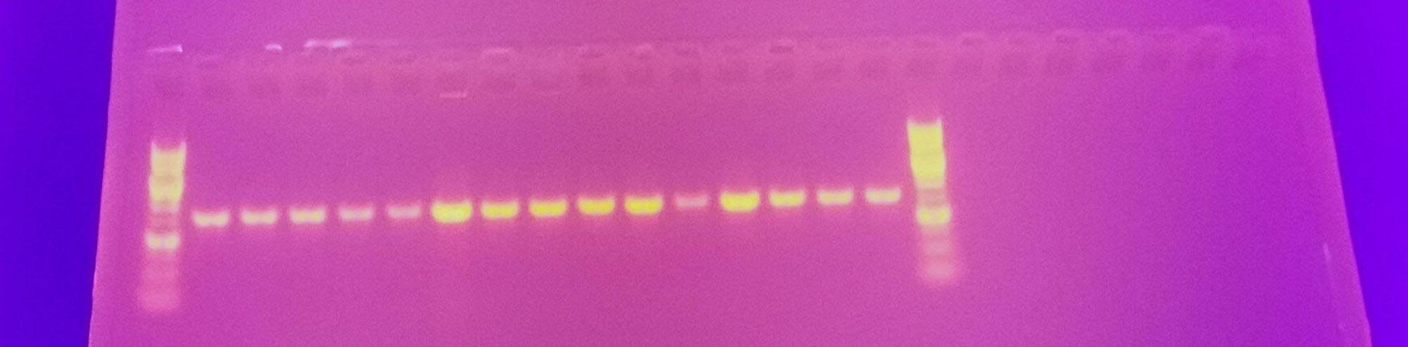 gel electrophoresis