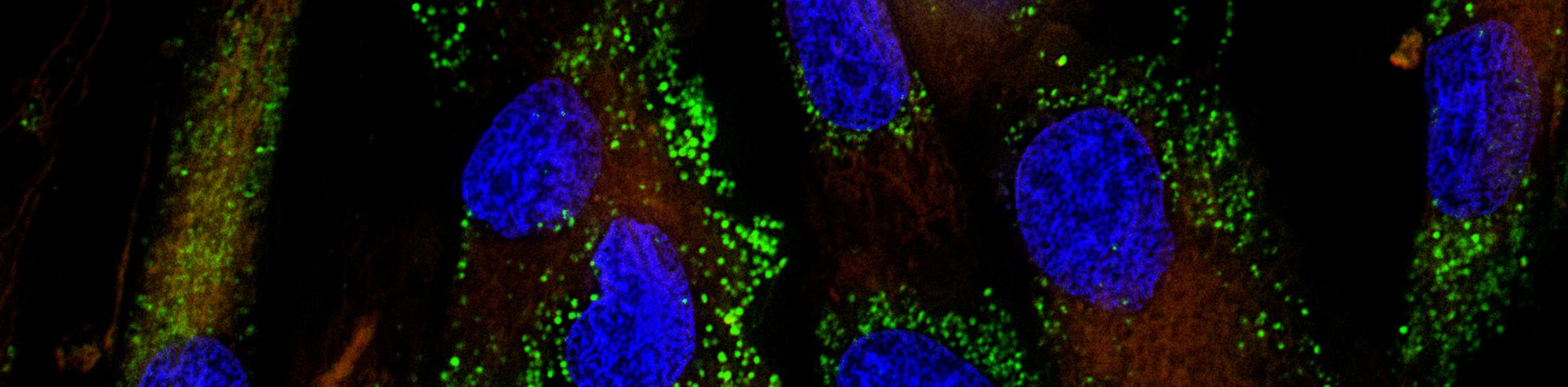 Fluorescence microscopy: A Basic Introduction