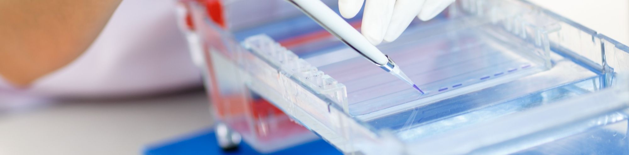 DNA Gel Electrophoresis Introduction & Overview