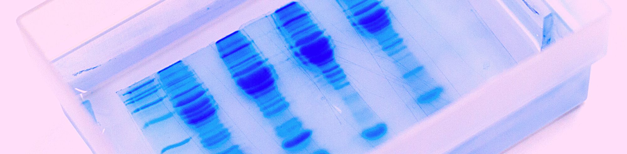 Western Blot Deep Dive: What It Is and How It Works