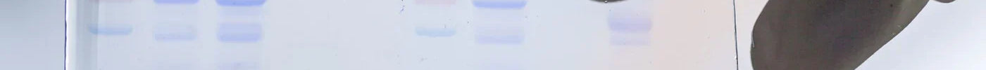 Protein Electrophoresis Using SDS-PAGE: A Detailed Overview