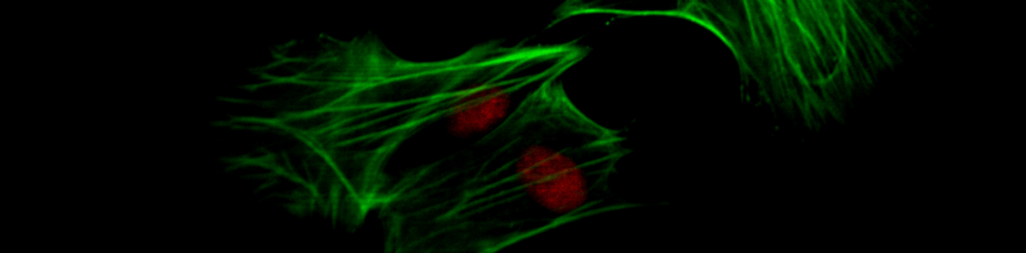 An Overview of Polyclonal and Monoclonal Antibodies: Their Differences and How to Choose