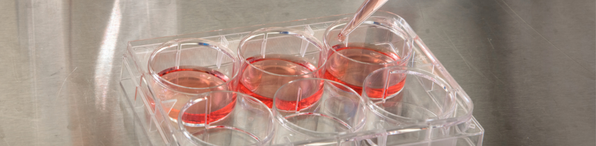 How to Detect Cell Culture Contamination