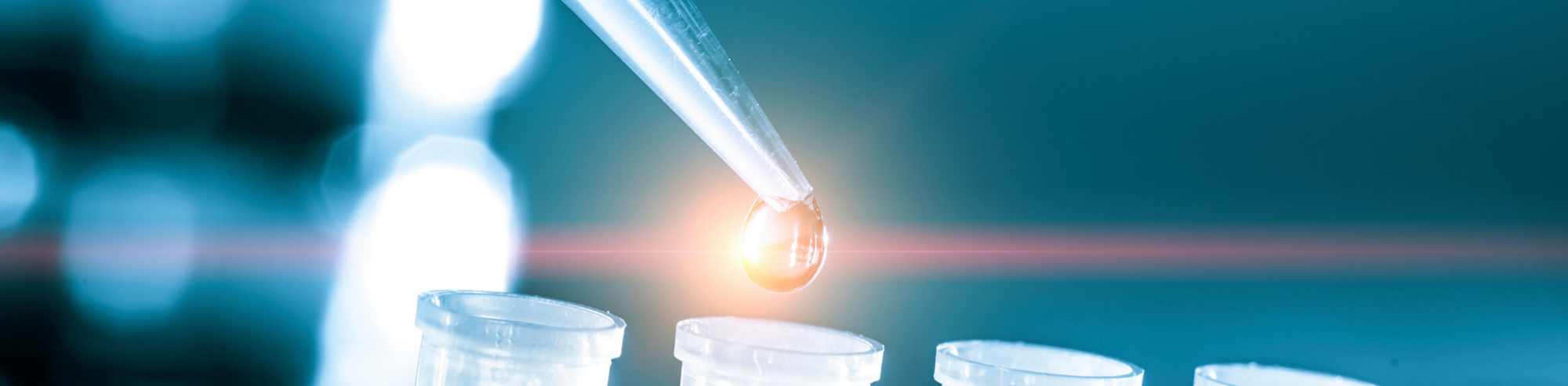 Introduction into Proteinase K