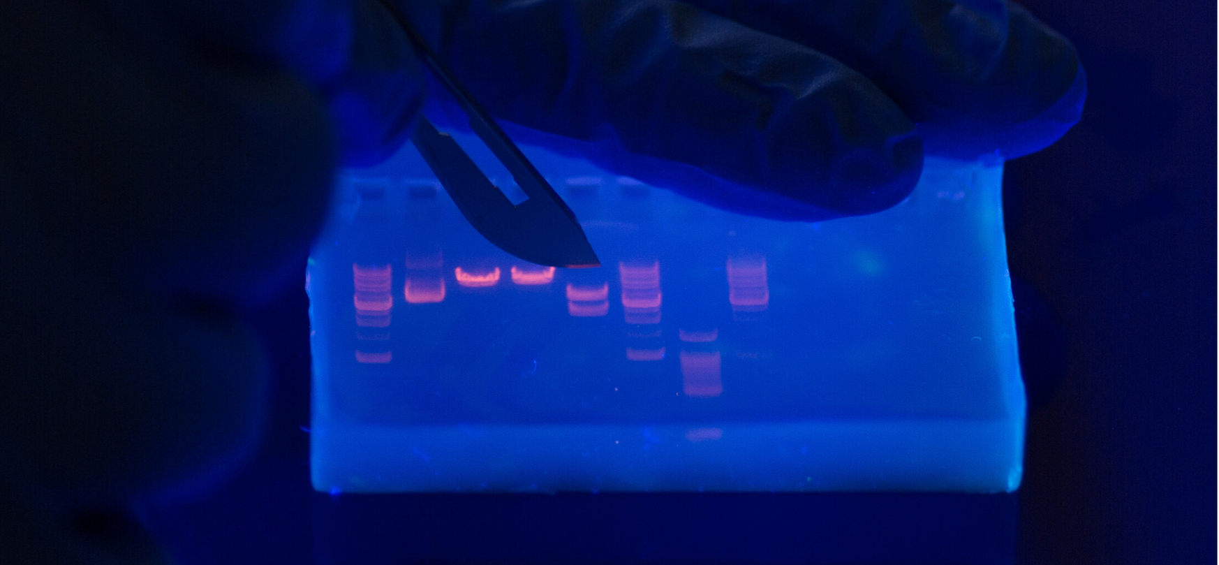 Interpreting gel electrophoresis results thumbnail