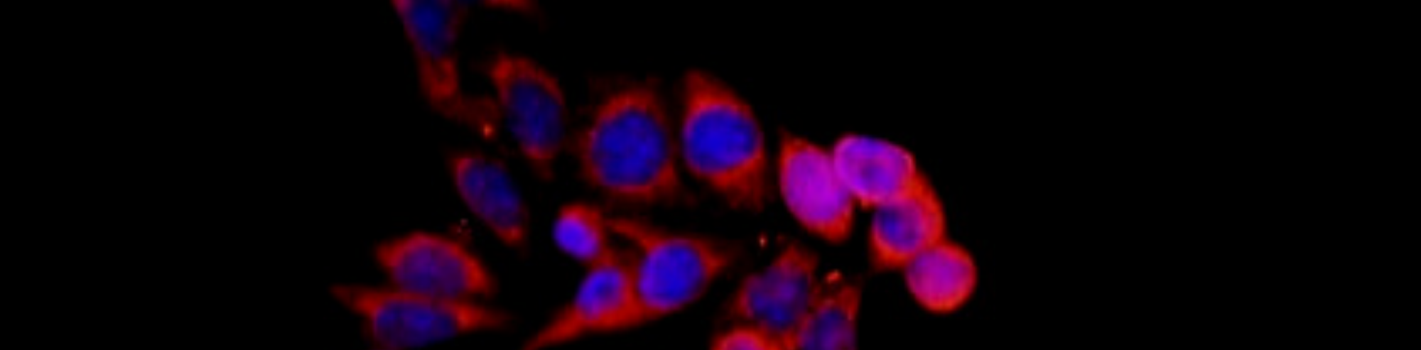 An Introduction to Primary Antibodies and Secondary Antibodies