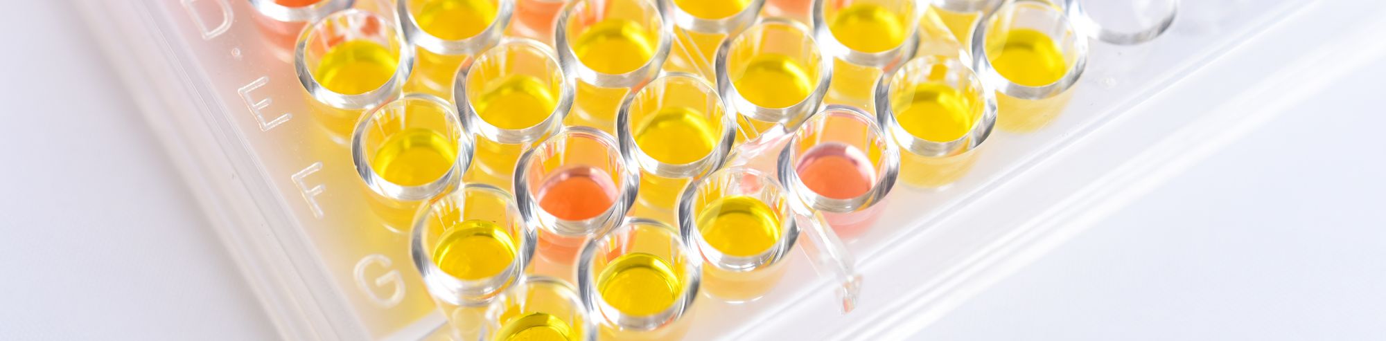 Detection Assays for Proteins:  Chromogenic vs Chemiluminescent vs Fluorometric