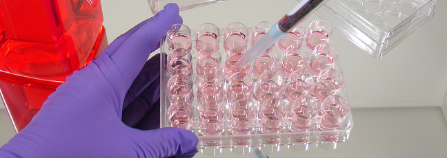 Why Test for Mycoplasma in My Cell Culture?