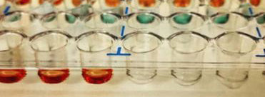 How to Really Choose a Cell Line - From the Basics to the Complex Aspects of Deciding on Your Cell Line