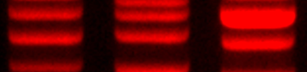 gelred dna bands close-up