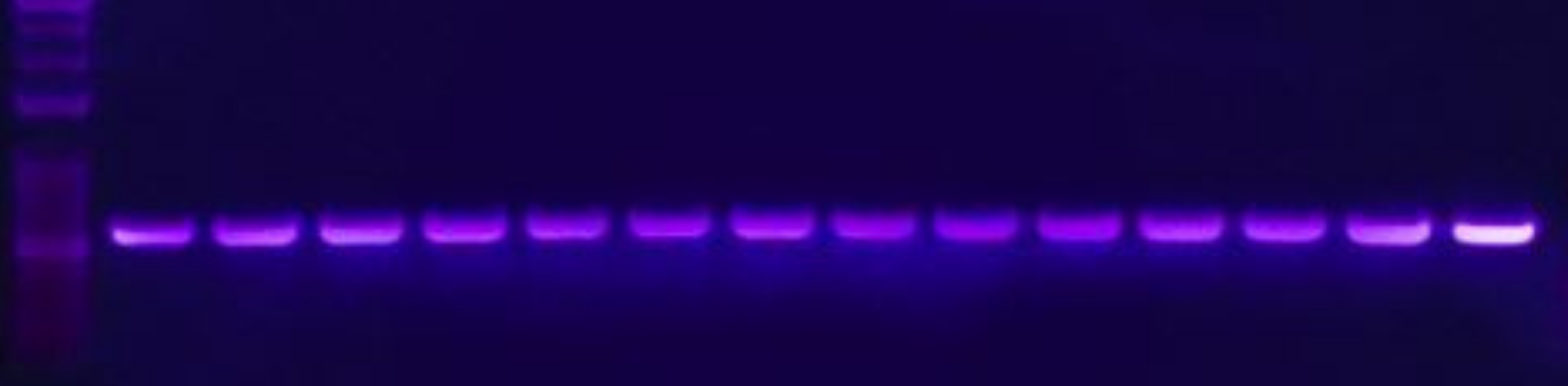 Cómo Interpretar Resultados de Electroforesis en Gel de ADN