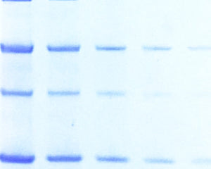 Protein electrophoresis products Tile image